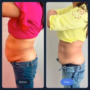 body_slimming_1