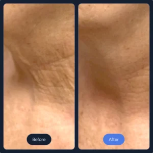 skin_2