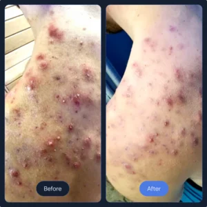 skin_3